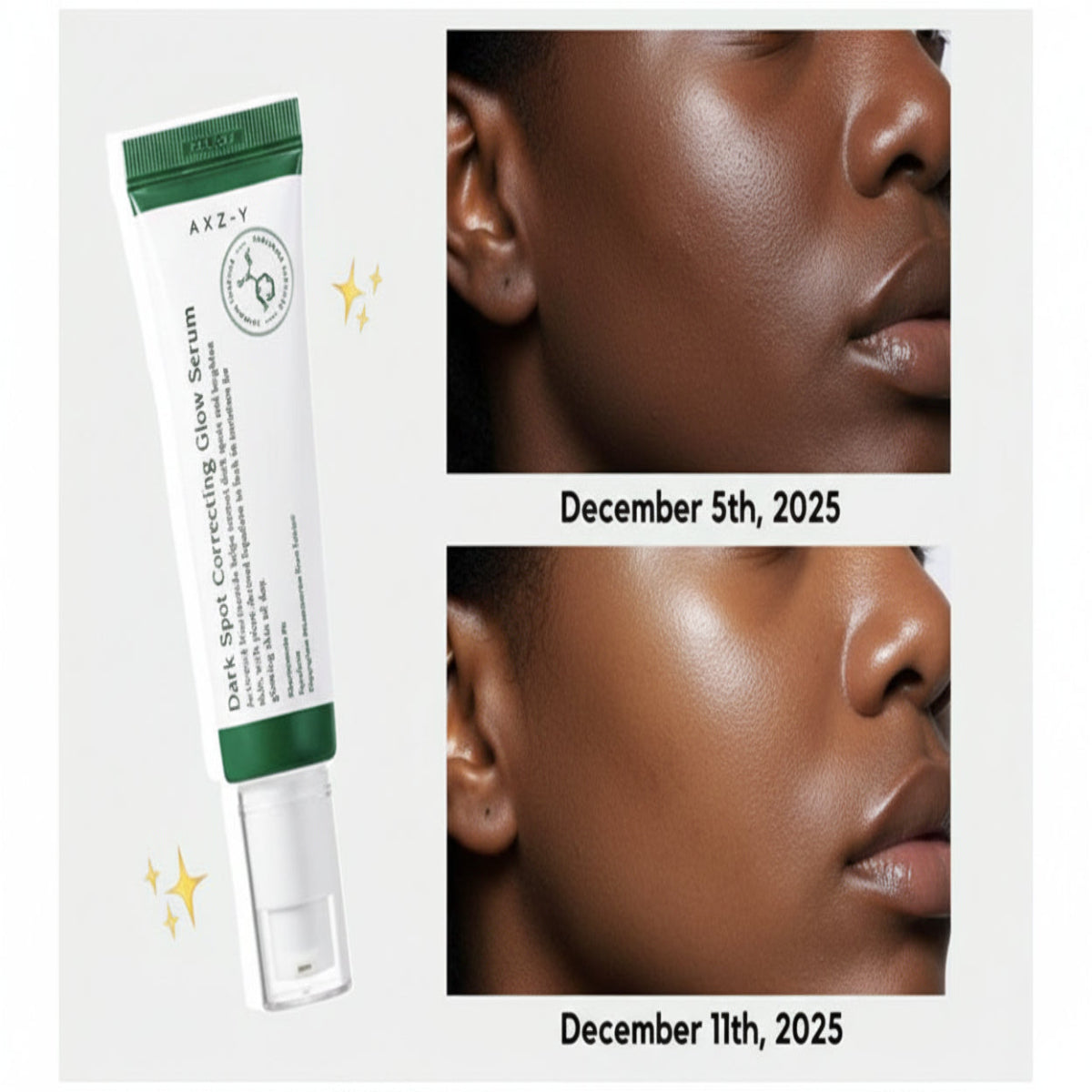 AXIS-Y Dark Spot Correcting Glow Serum